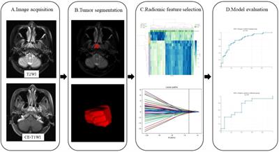 Radiomics based on pretreatment MRI for predicting distant metastasis of nasopharyngeal carcinoma: A preliminary study